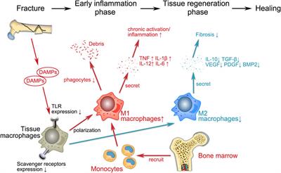 The promising roles of macrophages in geriatric hip fracture